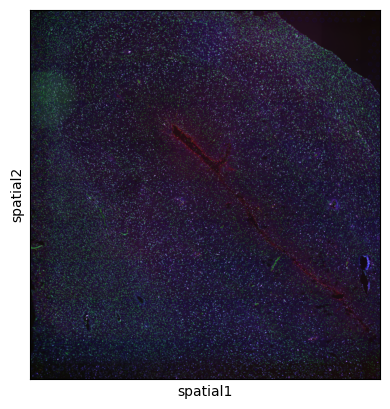 _images/Visium_brain01_3_0.png