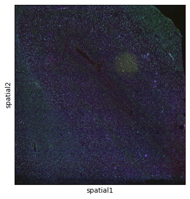 _images/Visium_brain01_4_0.png